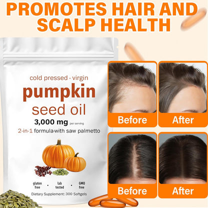 Pumpkin Seed Oil 3000mg Capsules