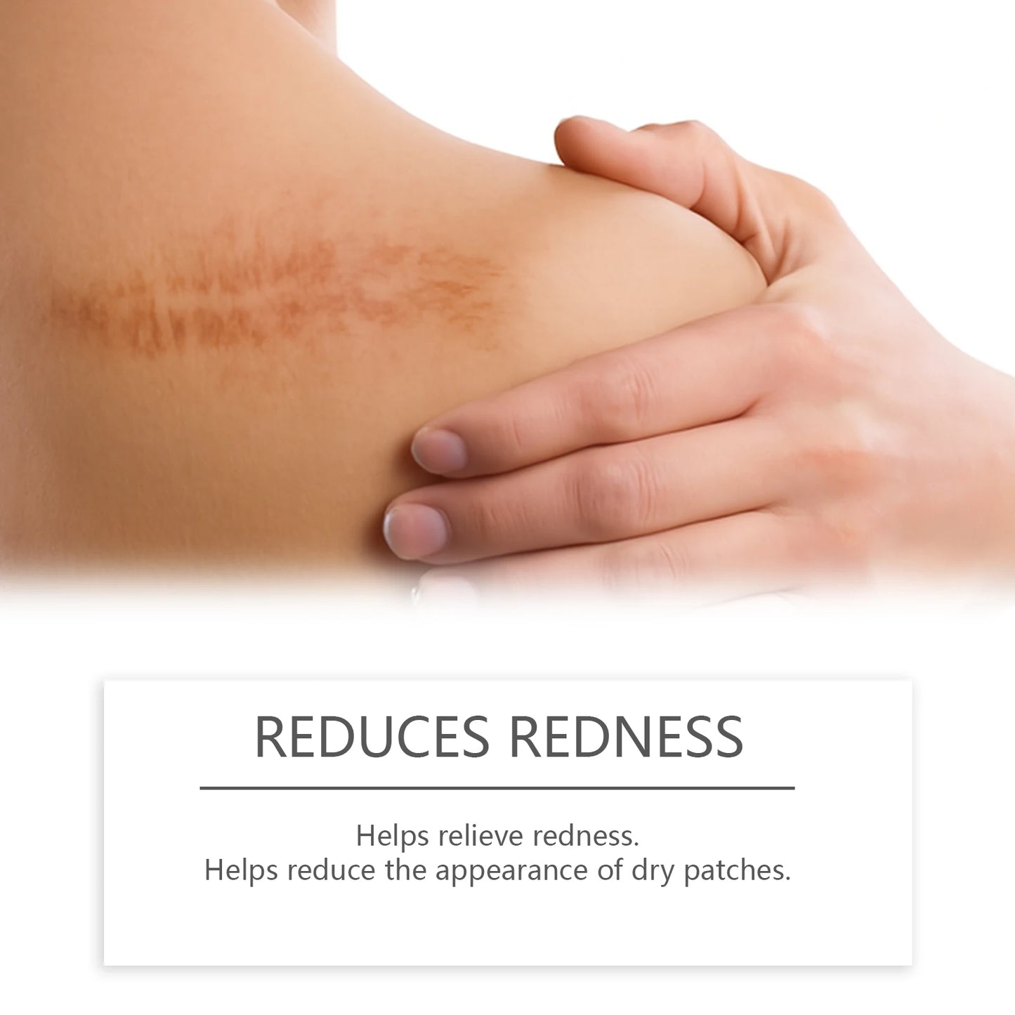 Derma Fade Silicone Stick